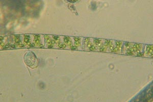 Spirogyra, Cothurnia