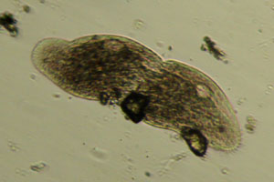 Spirotrich, dividing