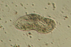 Spirotrich, dividing