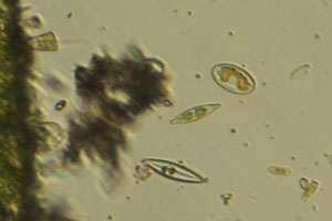 Diatoms