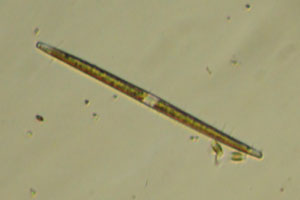 Diatom