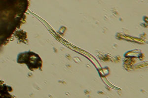 Roundworm