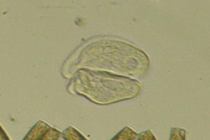 Phyllopharyngea conjugating