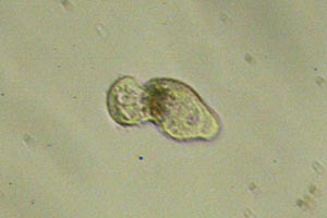 Ciliate