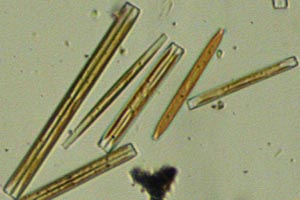 Diatoms