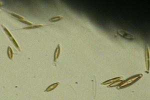 Diatoms