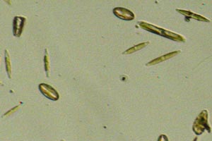 Diatoms