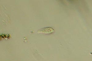 Ciliate