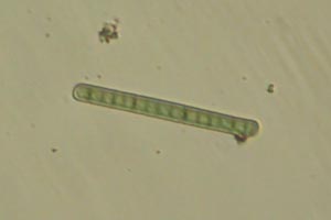 Cyanobacteria