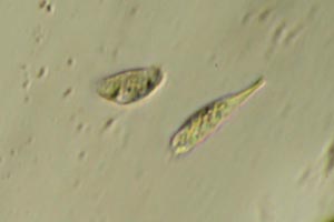 Ciliates