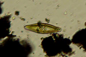 Diatom
