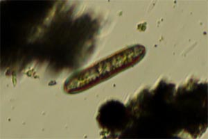 Diatom