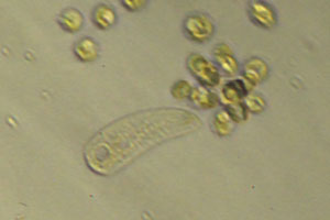 Ciliate