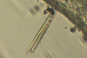 Diatoms