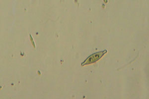 Diatoms
