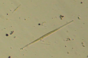 Diatoms