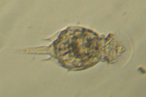 Squatinella