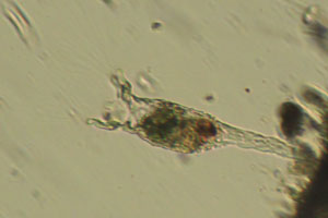 Collotheca