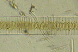 Diatoms