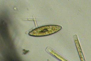 Diatom