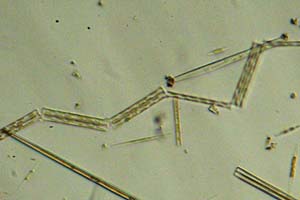 Diatoms