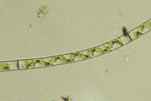Spirogyra