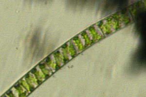 Spirogyra