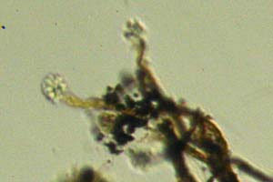 Anthophysa