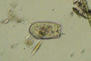 Ciliate