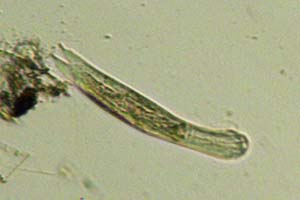 Chaetonotid