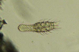 Chaetonotus