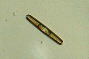 Diatom