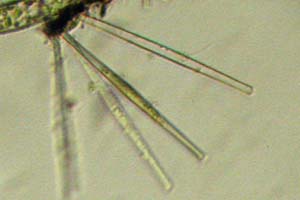 Diatoms