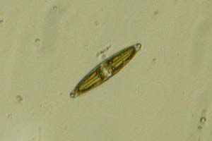 Diatom
