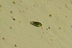 Euglenid