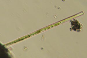 Diatom