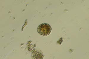 Dinoflagellate