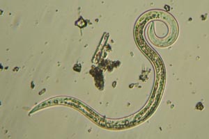 Roundworm