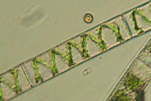 Spirogyra