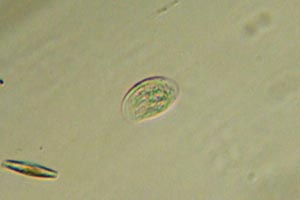 Ciliate