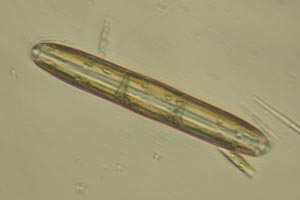 Diatom