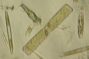 Diatoms