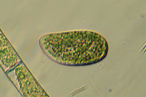 Paramecium