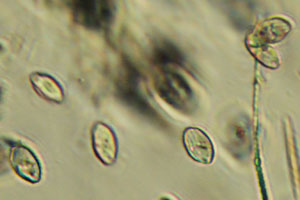 Ciliates