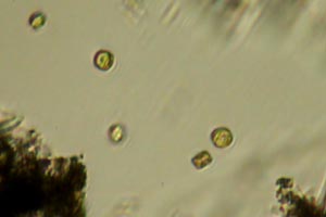 Diatoms