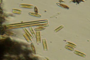 Diatoms