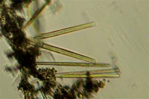 Diatoms