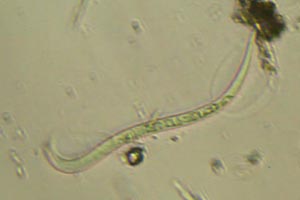 Roundworm