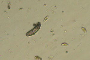 Diatoms