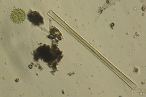 Diatoms, Hydrodictyaceae
